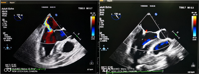 Unable to view the image, Please provide a valid URL.