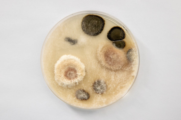 培养基中的微生物系戴森在深圳一户家中收集的灰尘所衍生