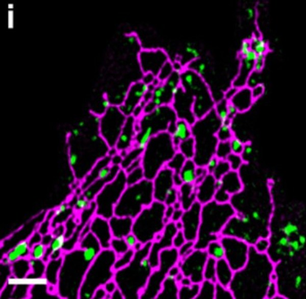 內質網（紫紅）和溶酶體（綠）的超高解析度成像，圖片來自于《Science Advances》發表的論文內容