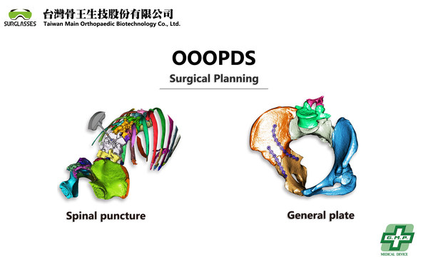 OOOPDS - a surgical planning software received TFDA Class-II medical device certification developed by Taiwan Main Orthopaedic Biotechnology Co., Ltd.
