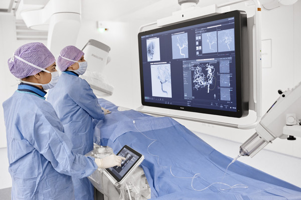 集成智能设备和临床应用软件的影像引导介入诊断治疗平台Azurion