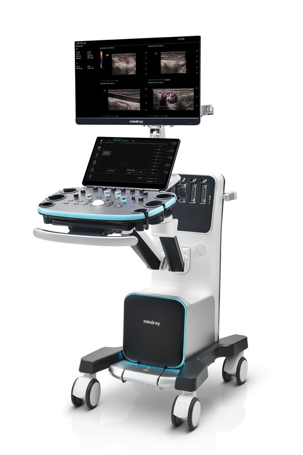 Mindray Meluncurkan Sistem Ultrasonografi Resona I9 sebagai Produk Pencitraan Medis yang Revolusioner