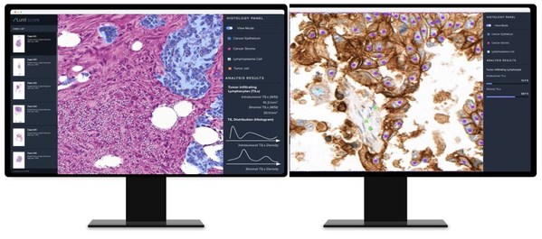AI-based Analysis of Cancer Tissue Predicts Response to Immunotherapy--Findings to Be Presented at ASCO 2021