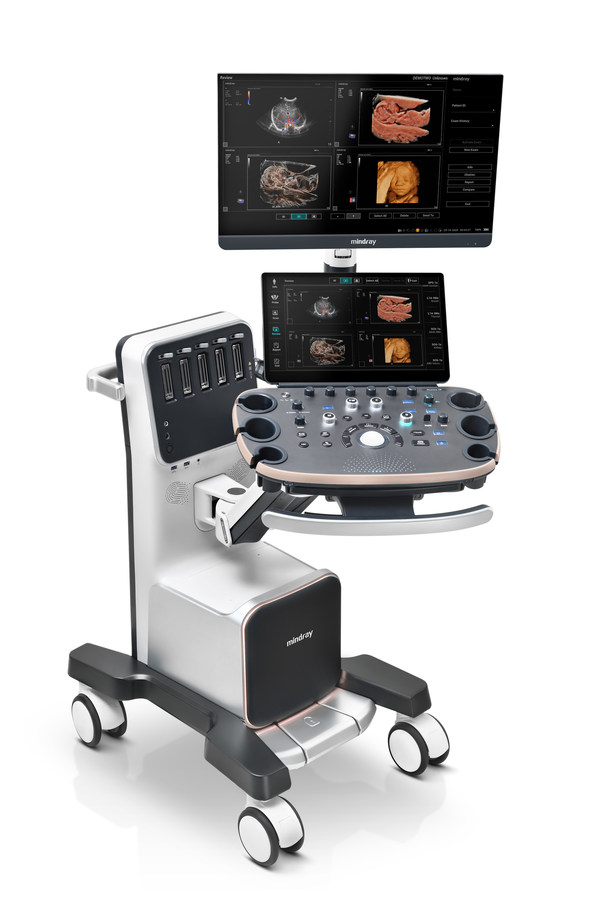 Inspiring Women's Healthcare: Mindray Unveils Nuewa I9, a New OB/GYN Diagnostic Ultrasound System