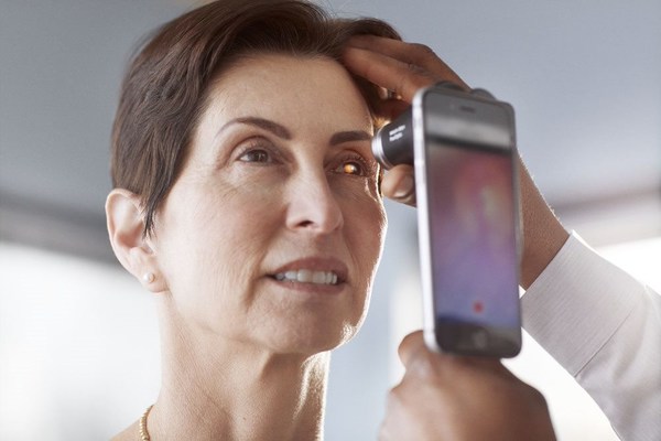 Digital image capture with the PanOptic Plus Ophthalmoscope