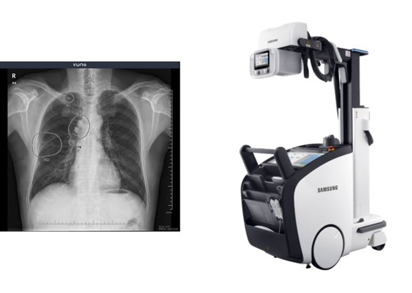VUNO Inks Deal with Samsung Electronics to Embed AI-powered Algorithms in Samsung's Premium Mobile X-ray System