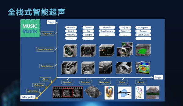 AFSUMB 2021：理邦全棧式智能醫學超聲正式發布
