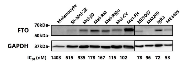 Figure 2. FTO protein expression determined by western blot.
