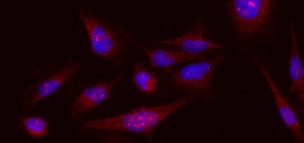 Figure 1. Melanoma cells stained with the BAK1 (red) and Dapi (blue).