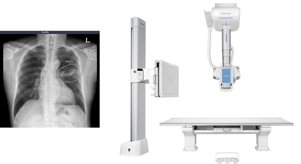 VUNO Signs Another Deal with Samsung Electronics to Incorporate AI-assisted Solutions into Samsung's Premium Ceiling Type Digital Radiography System
