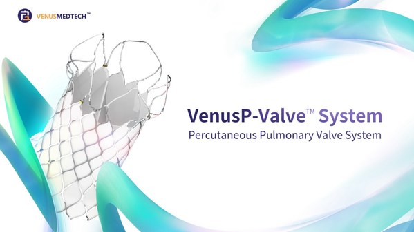 VenusP-Valve(TM) obtains CE marking under MDR and debuts in Europe as China's first valve product