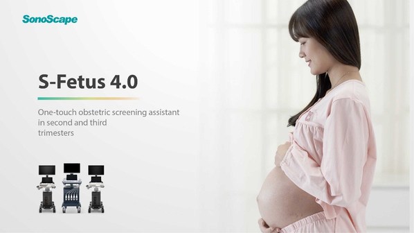 SonoScapeの出生前診断アシスタント「S-Fetus 4.0」