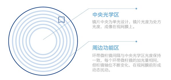 蔡司小乐圆镜片采用C.A.R.E.技术，构筑近视管理安全网