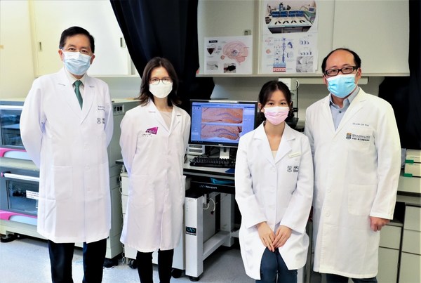 (L-R) Prof. Chan Ying-Shing, Dr Leanne Chan Lai-Hang, PhD Student Yu Wing-Shan, and Dr Lim Lee Wei, the principal investigator and also a former Singapore Lee Kuan Yew Research Fellow, discovered non-invasive stimulation of the eye for depression and dementia. (Source of photo: HKUMed Neuromodulation Laboratory)