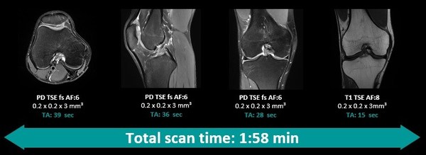 应用Deep Resolve，超高分辨率完整膝关节扫描可在2分钟以内完成，并提供高信噪比图像