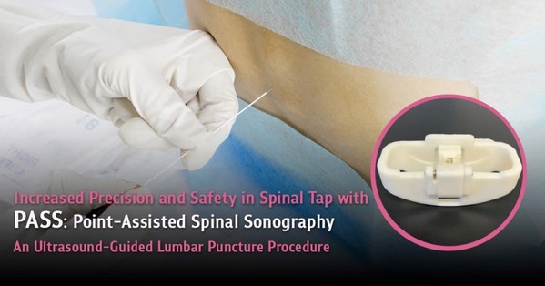 Increased Precision and Safety in Spinal Tap with PASS - An Ultrasound-Guided Lumbar Puncture Procedure