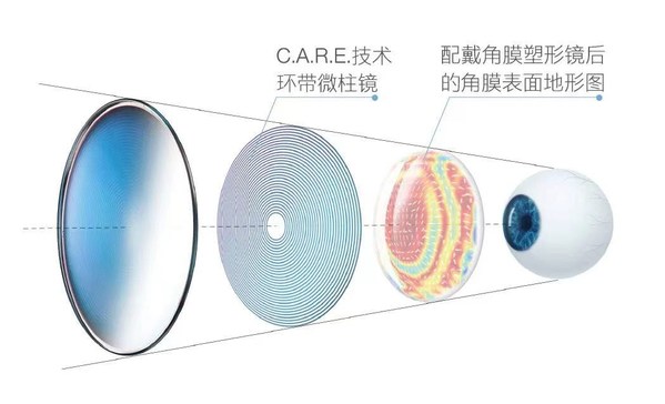 采用C.A.R.E专利技术的蔡司小乐圆镜片
