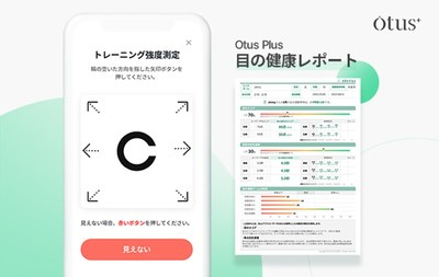 エデンルックスOtus（オータス）「AIによる目の健康レポート」サービス