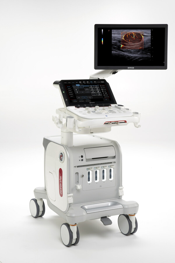 Esaote presents the world premiere of its new MyLab™X90 ultrasound device