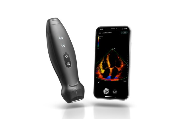 ワイヤレス携帯型超音波診断装置「TEエアー」、革新のアンテザー