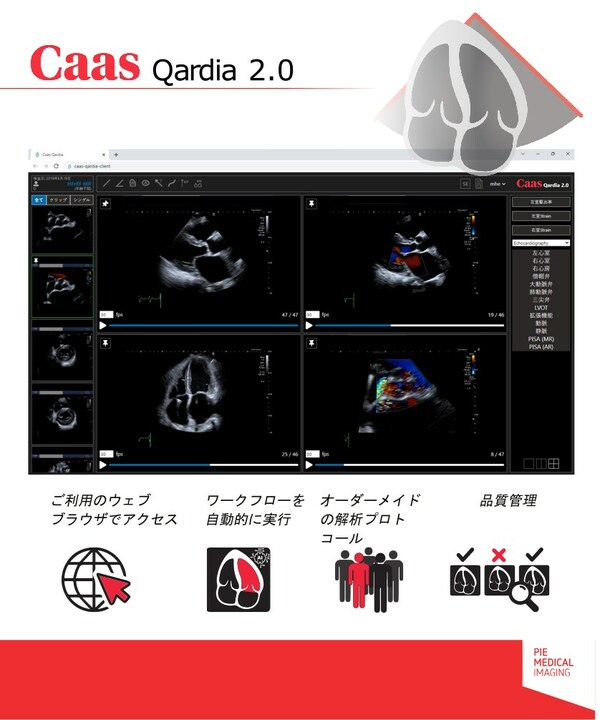 Pie Medical Imagingの革新的な心エコー検査ソフトウエア・プラットフォーム「CAAS Qardia」が日本で医療機器認証を取得