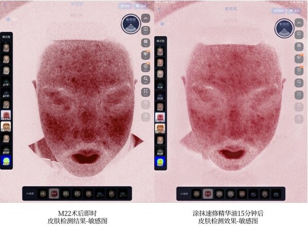 图片来源：君妍消费者体验后专业皮肤机器检测结果