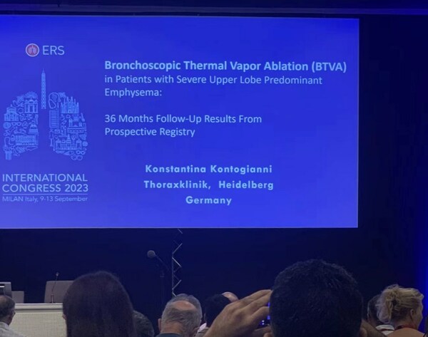 Broncus Announced Long-Term Follow-Up Data on InterVapor, Showing Stable Long-Term Efficacy in Patients
