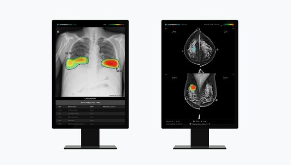 (from left to right) Lunit's AI-powered chest X-ray analysis solution 'Lunit INSIGHT CXR' and AI-powered mammography analysis solution 'Lunit INSIGHT MMG'
