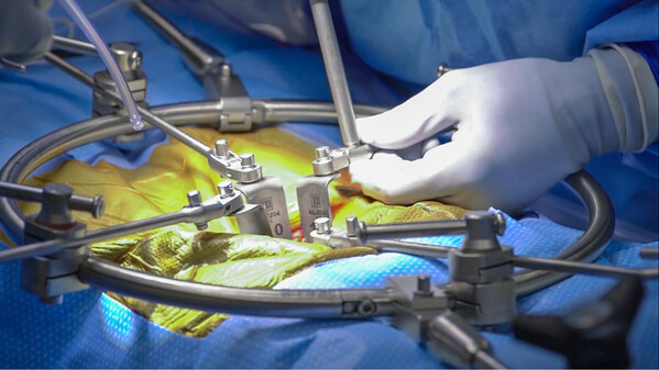 Phantom AL™ Anterior Lumbar Access System from TeDan Surgical Innovations