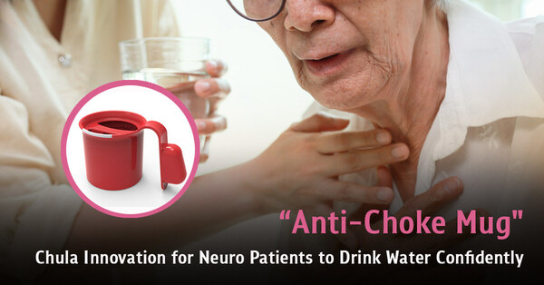 "Anti-Choke Mug" - Chula Innovation for Neuro Patients to Drink Water Confidently