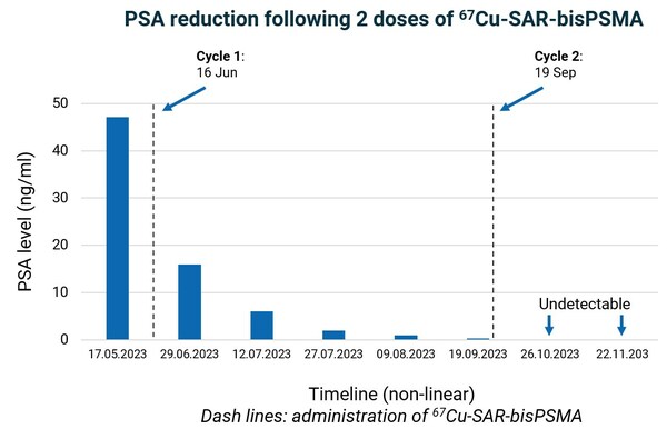 Figure 3. PSA dynamics over time. Series of PSA test results show baseline and decrease over time after the administration of one cycle of Cu-67 SAR-bisPSMA. PSA level was undetectable in the last 2 measurements after the second cycle of Cu-67 SAR-bisPSMA. Lower level of detection: 0.05 ng/ml.