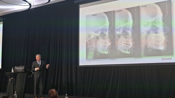 Professor Shen's lecture emphasized Smartee Mandibular Repositioning TECHNOLOGY which aims to reposition the mandible forward, promote TMJ remodeling, restore Class I occlusion, and treat severe Class II and Class III malocclusions effectively.