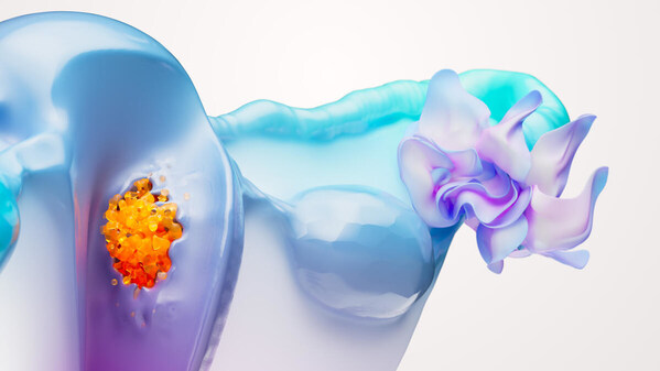 Artistic representation of endometrial cancer (image by GSK)