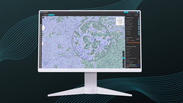 Lunit's AI-powered tool for immune phenotyping and tumor-infiltrating lymphocytes analysis, Lunit SCOPE IO, has demonstrated its potential in predicting immunotherapy response for patients with advanced biliary tract cancer. (image credit: Lunit)