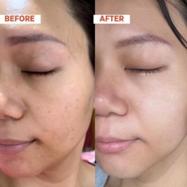 Modern Molecules Renewal Serum: Before and After Results Following 8 Weeks of Clinical Trials