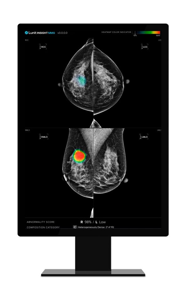 Lunit INSIGHT MMG, Lunit's AI-powered mammography analysis solution, showcased its ability to predict breast cancer risk and assist in streamlining radiologist workflows.