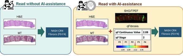 BRIDGING CLINICAL RESEARCH AND CLINICAL CARE WITH AI-AIDING PATHOLOGISTS TOOL