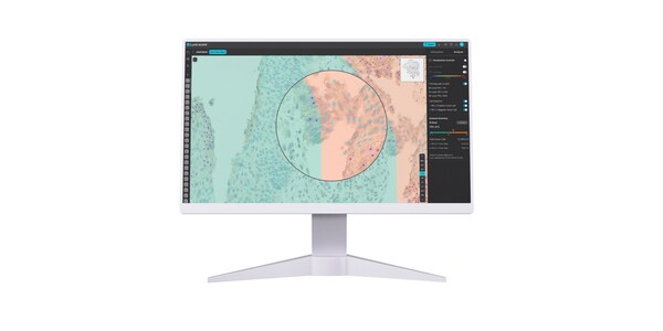 CISION PR Newswire - New Lunit Study Demonstrates Universal AI Model for Analysis of Immunohistochemistry Images